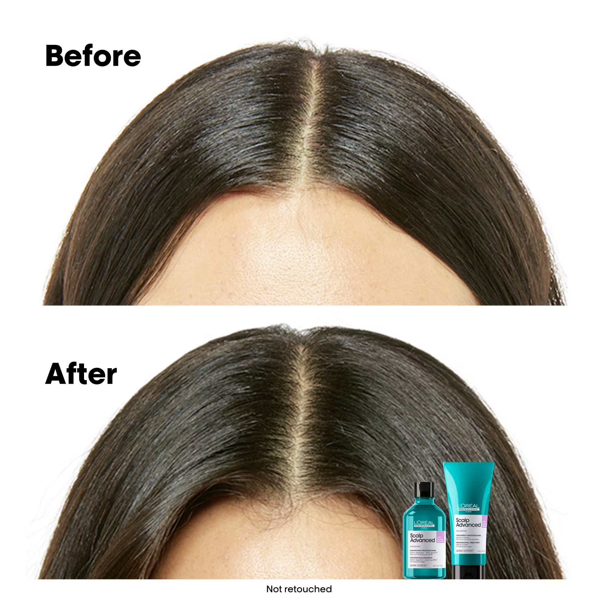L’Oréal Anti-Discomfort Intense Soother Treatment 200 ml