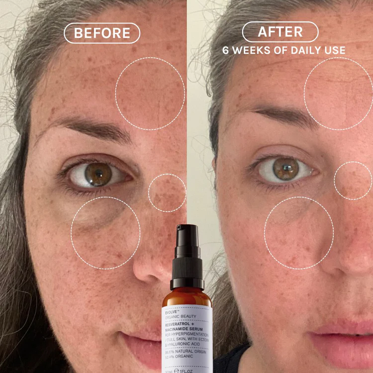 EVOLVE Resveratrol + Niacinamide Serum - Serum - JK-Shop