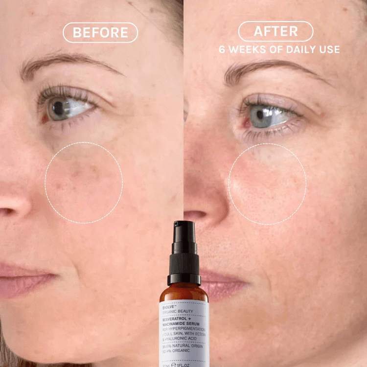 EVOLVE Resveratrol + Niacinamide Serum 30ml-Ansiktsserum-JKSHOP