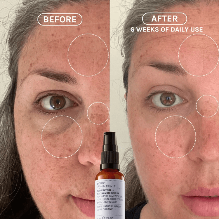 EVOLVE Resveratrol + Niacinamide Serum 30ml-Ansiktsserum-JKSHOP