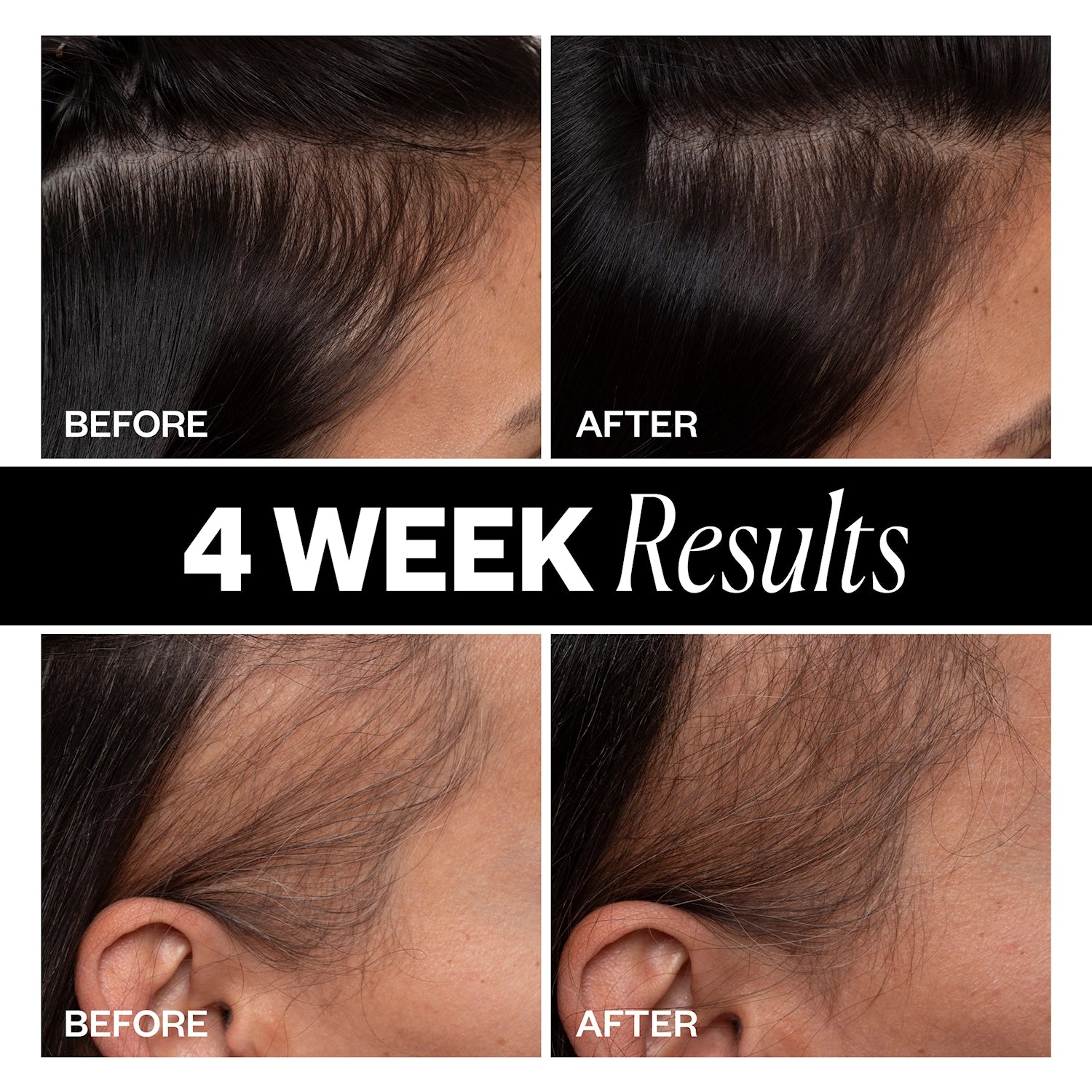 IGK Sponsored Hair Density Scalp Treatment 63 ml