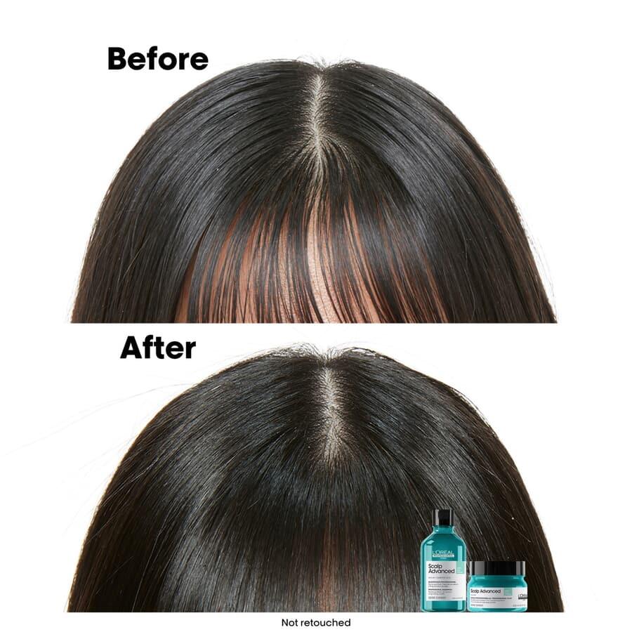 L’Oréal Anti-Oiliness 2-In-1 Deep Purifier Clay 250 ml