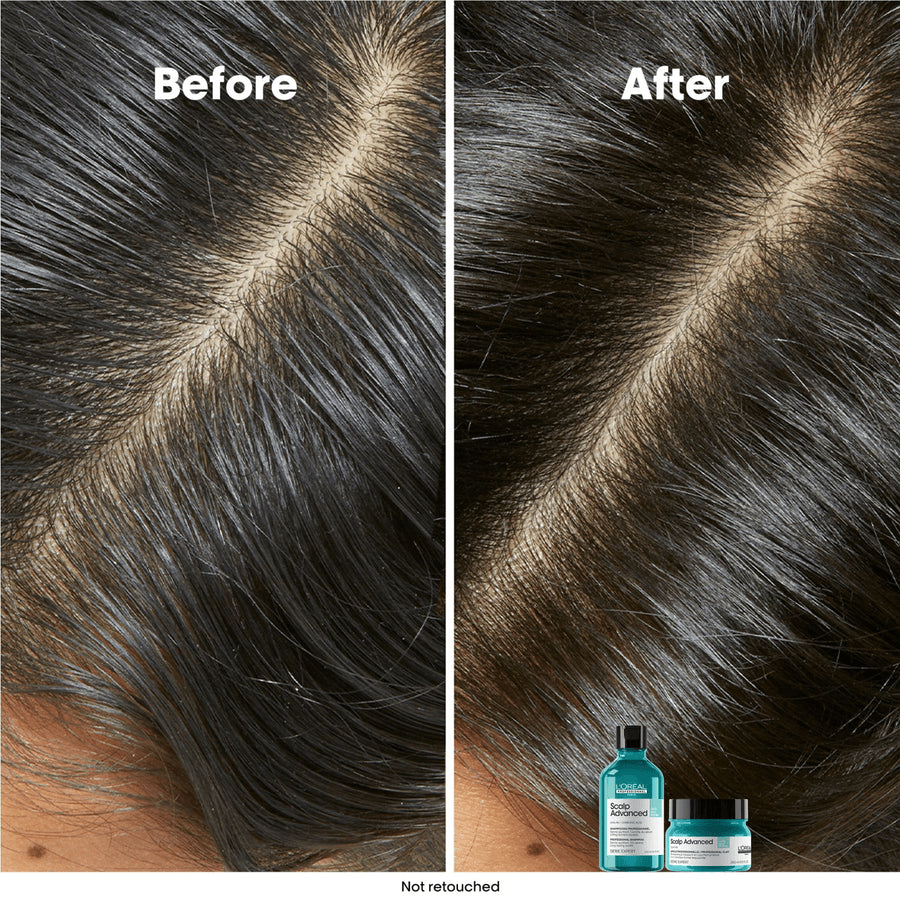 L’Oréal Anti-Oiliness Dermo-Purifier Shampoo 300 ml