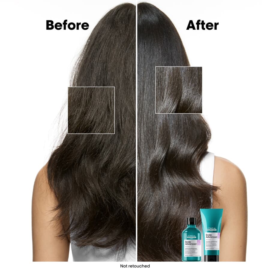 L’Oréal Anti-Discomfort Intense Soother Treatment 200 ml