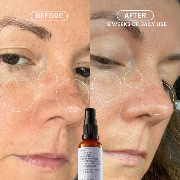 EVOLVE Resveratrol + Niacinamide Serum - Serum - JK-Shop