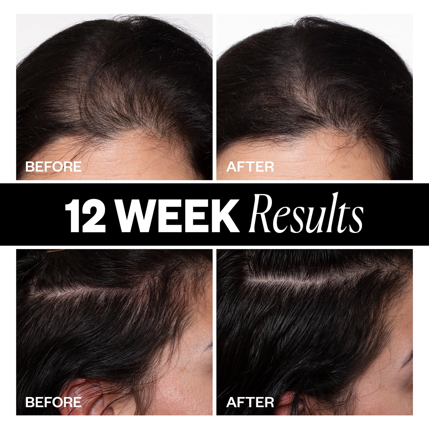 IGK Sponsored Hair Density Scalp Treatment 63 ml