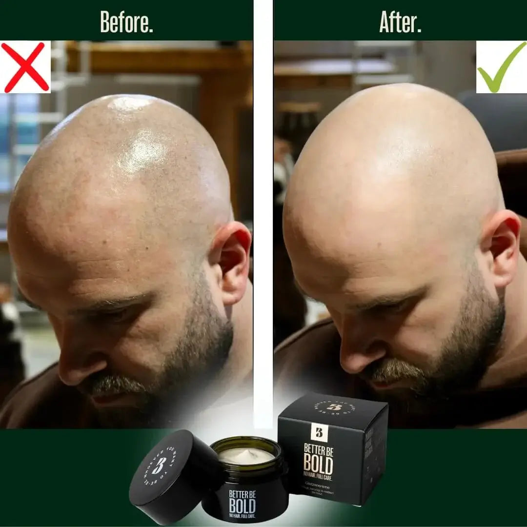 Better Be Bold, Moisturizing Bald Cream- Matt Effect-Hodebunnspleie-JKSHOP