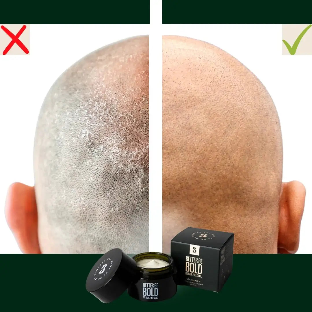 Better Be Bold, Moisturizing Bald Cream- Matt Effect-Hodebunnspleie-JKSHOP