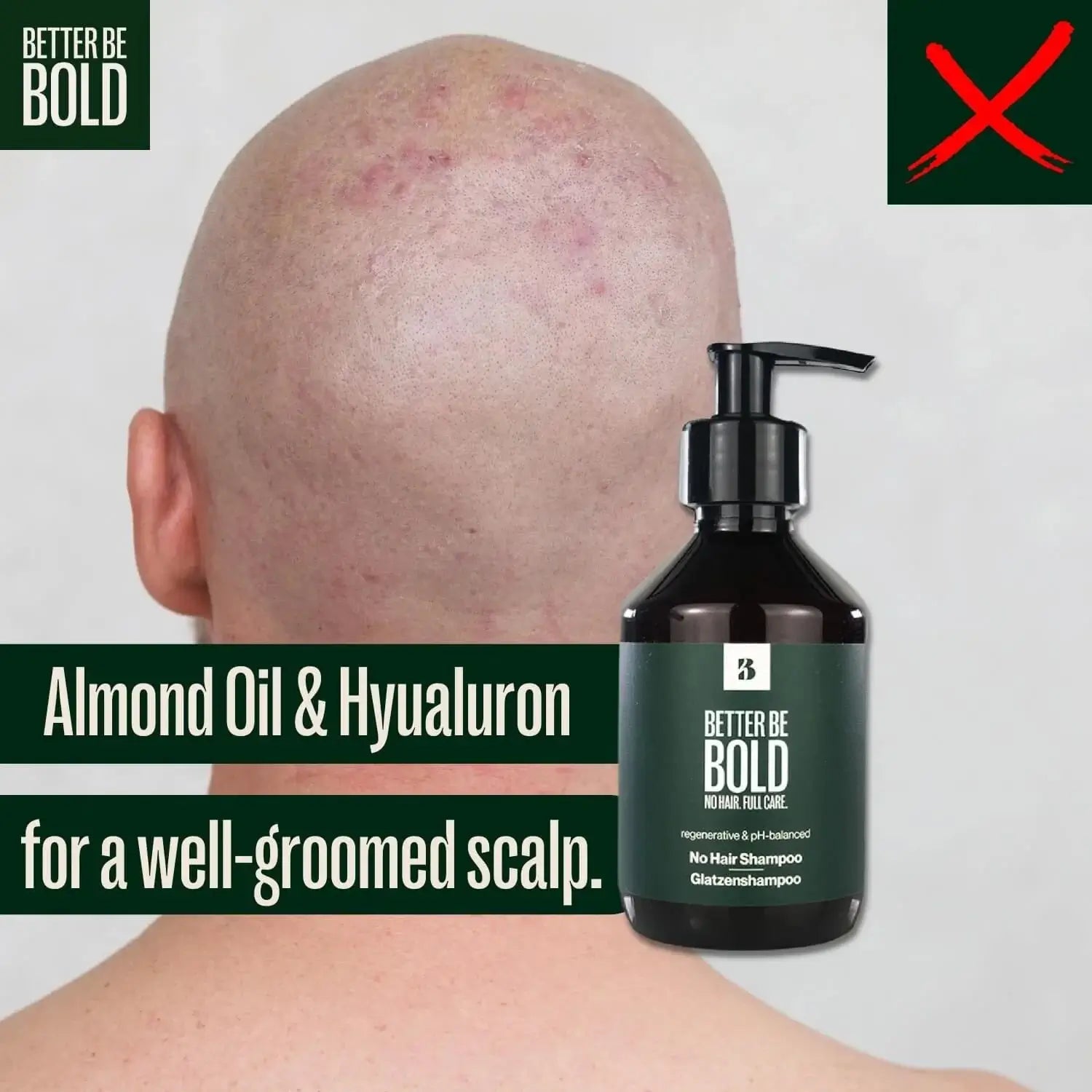 Better Be Bold, Moisturizing "No Hair" Shampoo-Sjampo-JKSHOP