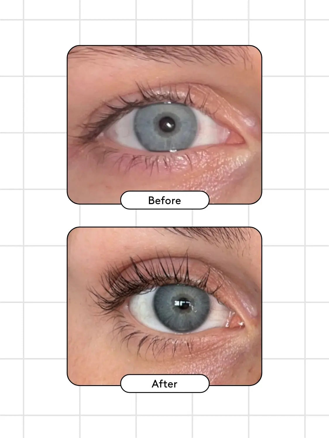 Xlash, Eyelash Serum-Vippeserum-JKSHOP