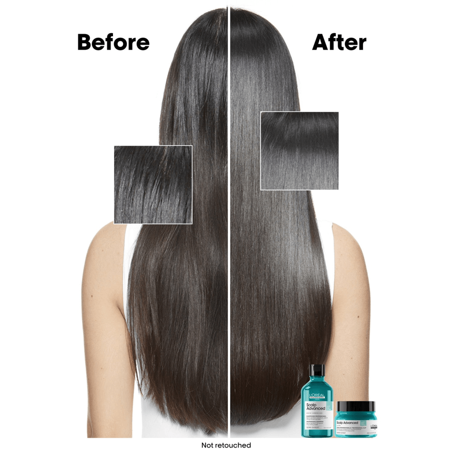 L’Oréal Anti-Oiliness Dermo-Purifier Shampoo 300 ml