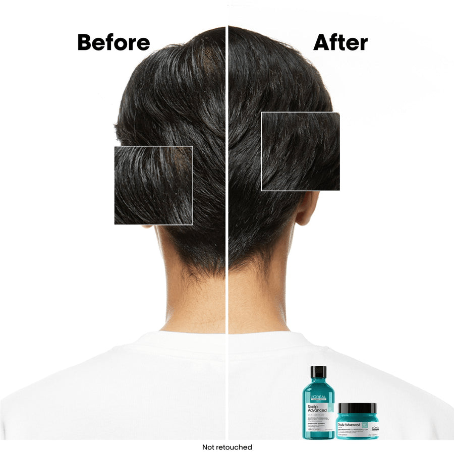 L’Oréal Anti-Oiliness Dermo-Purifier Shampoo 300 ml