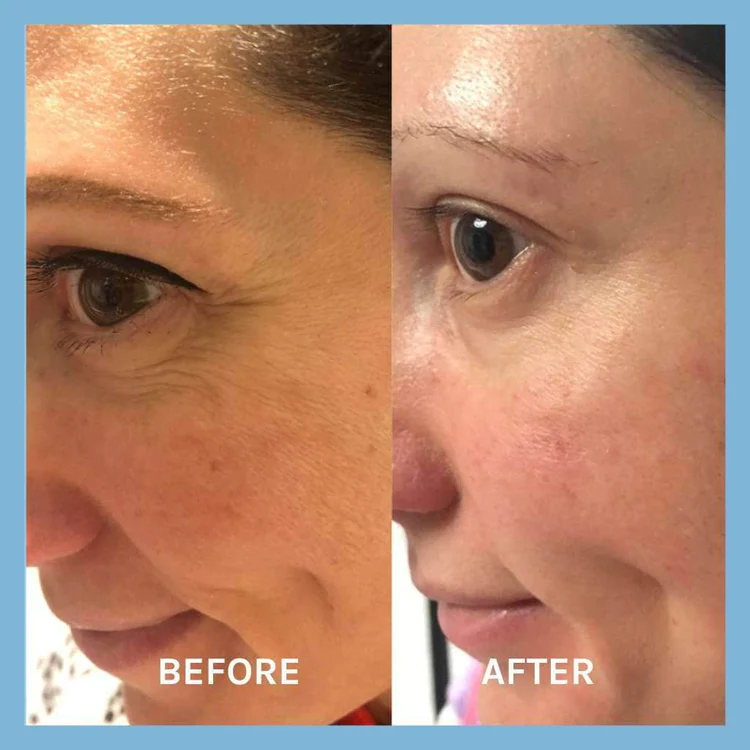 EVOLVE Age Defying Lifting Serum